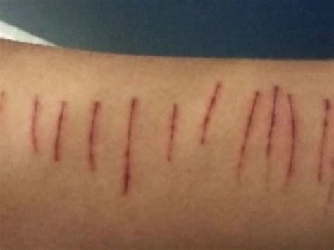 Fueron detectados 6 casos de cutting
