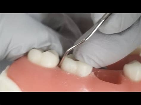 perio instrument part  basic introduction perio explorer youtube