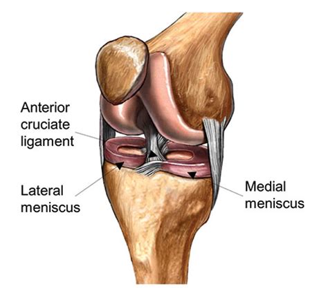 ACL Reconstruction - Parkside Hospital