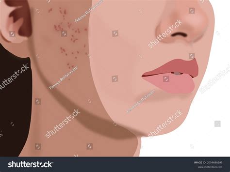 840 Acne Embarrassed Images, Stock Photos & Vectors | Shutterstock