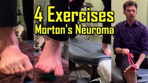 Exercises to AVOID Surgery | How To Heal Mortons Neuroma Quickly - YouTube