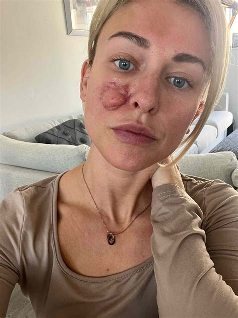 Dog Owner Says Her Cocker Spaniel Attacked Her Face Unprompted: ‘So Shocked’