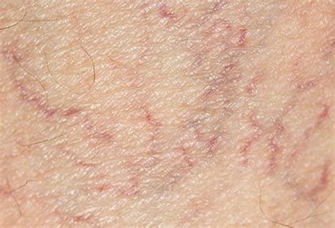 visual guide  vein  artery problems stay healthy weekly