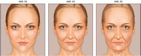 understanding facial aging  orleans la  orleans facial aging