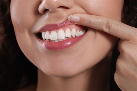 healthy gums     normal color