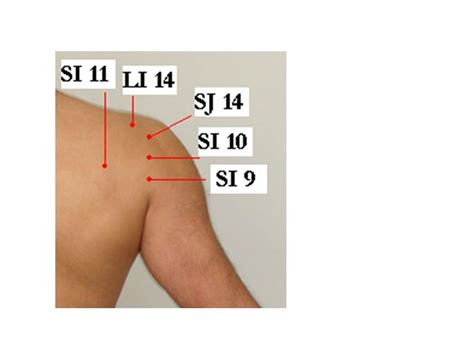 59. Frozen Shoulder and Acupuncture Treatment « Jun Xu, M.D. (203) 637 ...