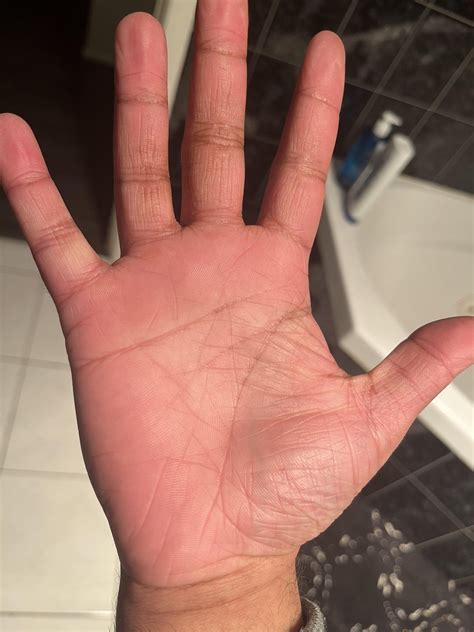 im curious      broken lines  rpalmistry