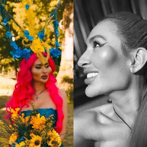 Cine este femeia cu cei mai proeminenți pomeți din lume. Cum arăta