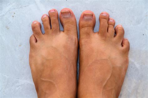 Foot & Lower Limb Health Blog - Straits Podiatry