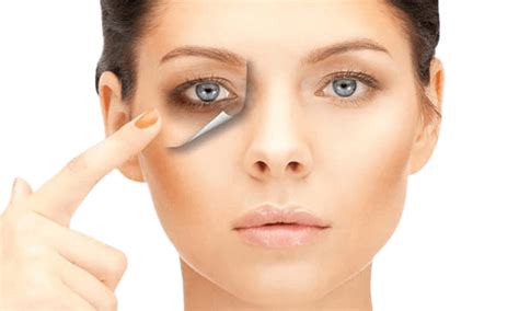 dark circle treatment invivo hospitals