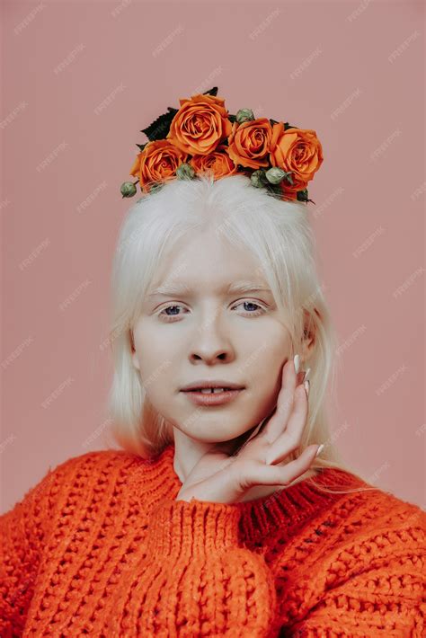 Premium Photo | Lifestyle image of an albino girl posing in studio